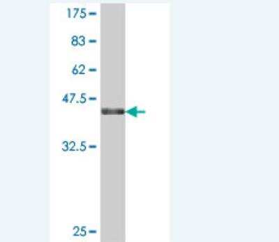 Western Blot: MAST4 Antibody [H00375449-A01] - Detection against Immunogen (36.56 KDa) .