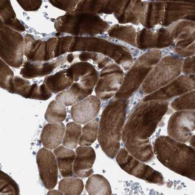 Immunohistochemistry-Paraffin: MATE1 Antibody [NBP1-87909] - Staining of human skeletal muscle shows  strong cytoplasmic positivity in myocytes.