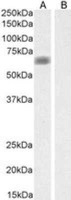 Western Blot: MATE1 Antibody [NBP1-36989] - Staining of Human Liver lysate (35 ug protein in RIPA buffer) with antibody at 0.1 ug/mL. Detected by chemiluminescence. Approx. 60-65kDa band observed in Human Liver lysates (calculated MW of 61.9 kDa according to NP_060712.2). This band was successfully blocked by incubation with the immunizing peptide. 