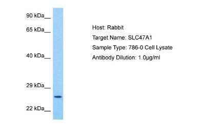 Western Blot: MATE1 Antibody [NBP2-85258] - Host: Rabbit. Target Name: SLC47A1. Sample Tissue: Human 786-0 Whole Cell lysates. Antibody Dilution: 1ug/ml