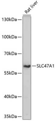 Western Blot: MATE1 Antibody [NBP3-03733] - Analysis of extracts of rat liver, using MATE1 antibody at 1:1000 dilution. Secondary antibody: HRP Goat Anti-Rabbit IgG (H+L) at 1:10000 dilution. Lysates/proteins: 25ug per lane. Blocking buffer: 3% nonfat dry milk in TBST. Detection: ECL Basic Kit .