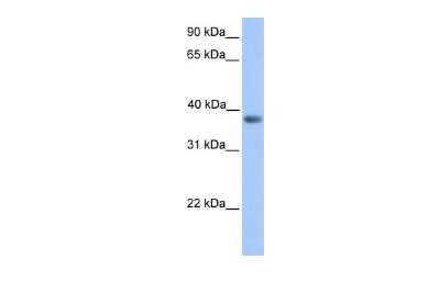 Western Blot: MATH2/NEUROD6 Antibody [NBP3-10938] - Western blot analysis of MATH2/NEUROD6 in Transfected 293T as a positive control. Antibody dilution at 0.2-1 ug/ml