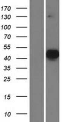 Western Blot: MATH2/NEUROD6 Overexpression Lysate (Adult Normal) [NBP2-06416] Left-Empty vector transfected control cell lysate (HEK293 cell lysate); Right -Over-expression Lysate for MATH2/NEUROD6.