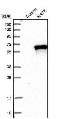 Western Blot: MATK Antibody [NBP1-84487] - Analysis in control (vector only transfected HEK293T lysate) and MATK over-expression lysate (Co-expressed with a C-terminal myc-DDK tag (3.1 kDa) in mammalian HEK293T cells).