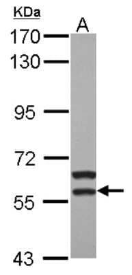 Western Blot: MATK Antibody [NBP2-17231] - Sample (30 ug of whole cell lysate) A: HepG2 7. 5% SDS PAGE gel, diluted at 1:1000.