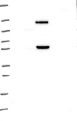 Western Blot: MATK Antibody [NBP3-17887] - Lane 1: Marker [kDa] 250, 130, 95, 72, 55, 36, 28, 17, 10;   Lane 2: RT4;   Lane 3: U-251 MG;   Lane 4: Human Plasma;   Lane 5: Liver;   Lane 6: Tonsil