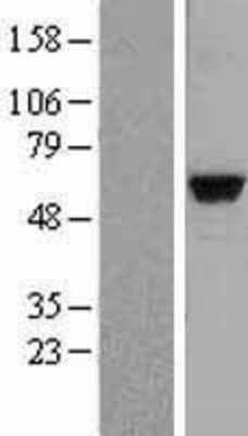 Western Blot: MATK Overexpression Lysate (Adult Normal) [NBL1-12914] Left-Empty vector transfected control cell lysate (HEK293 cell lysate); Right -Over-expression Lysate for MATK.