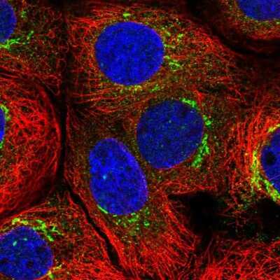 Immunocytochemistry/Immunofluorescence: MATN3 Antibody [NBP2-56235] - Staining of human cell line A-431 shows localization to the Golgi apparatus.