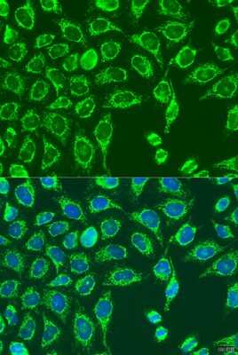 Immunocytochemistry/Immunofluorescence: MATN3 Antibody [NBP3-04918] - Analysis of U2OS cells using MATN3 antibody at dilution of 1:100. Blue: DAPI for nuclear staining.