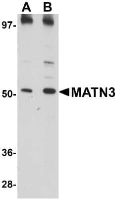 Western Blot: MATN3 Antibody [NBP1-77017] - 3T3 cell lysate with MATN3 antibody at (A) 1 and (B) 2 ug/mL.