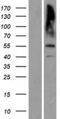 Western Blot: MATN3 Overexpression Lysate (Adult Normal) [NBP2-08119] Left-Empty vector transfected control cell lysate (HEK293 cell lysate); Right -Over-expression Lysate for MATN3.