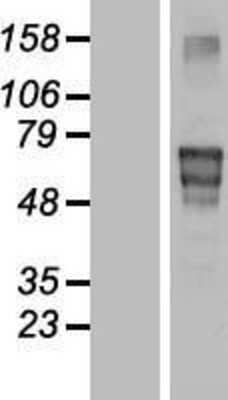 Western Blot Matrilin-4 Overexpression Lysate