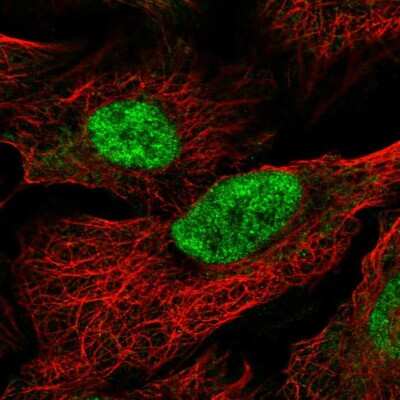 Immunocytochemistry/Immunofluorescence: MAU2 Antibody [NBP2-56151] - Staining of human cell line U-2 OS shows localization to nucleoplasm.