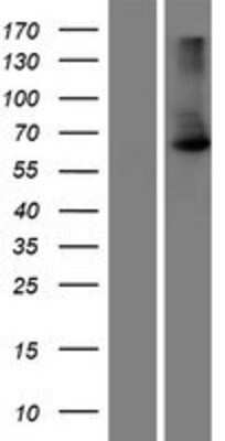 Western Blot: MAU2 Overexpression Lysate (Adult Normal) [NBP2-07191] Left-Empty vector transfected control cell lysate (HEK293 cell lysate); Right -Over-expression Lysate for MAU2.