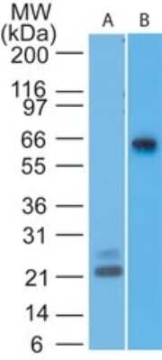 Western Blot: MAVS Antibody (58N2B2) [NBP2-22379] - Analysis of A) partial recombinant protein and B) human Jurkat lysate using MAVS antibody at 0.1 ug/ml and 2 ug/ml, respectively. goat anti-mouse Ig HRP secondary antibody and PicoTect ECL substrate solution were used for this test.