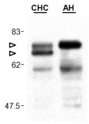 Western Blot: MAVS Antibody (Adri-1) - BSA Free [NBP2-80052] - Cardif is cleaved in liver of a patient infected by the hepatitis C virus. Protein extracts of liver biopsies from a patient with chronic hepatitis C (CHC) and as a control from a patient with alcoholic hepatitis (AH) were run on a SDS-gel and revealed with anti-Cardif (human), mAb (Adri-1) (Prod. No. NBP2-80052).