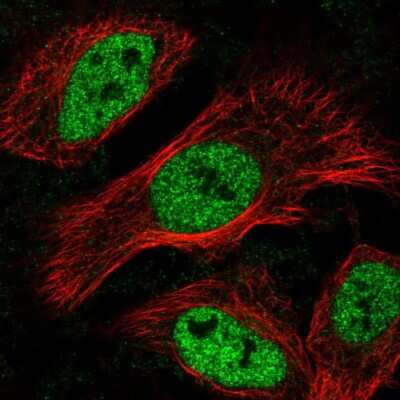 Immunocytochemistry/Immunofluorescence: MAX binding protein Antibody [NBP2-56563] - Staining of human cell line HeLa shows localization to nucleoplasm.