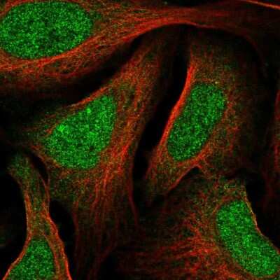 Immunocytochemistry/Immunofluorescence: MAX binding protein Antibody [NBP2-57009] - Staining of human cell line U-2 OS shows localization to nucleus.