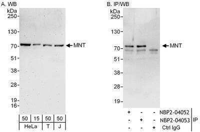 Immunoprecipitation: MAX binding protein Antibody [NBP2-04052] - Samples:  Whole cell lysate from HeLa (15 and 50 ug for WB; 1 mg for IP, 20% of IP loaded), 293T (T; 50 ug) and Jurkat (J; 50 ug) cells. Antibodies: Affinity purified rabbit anti-MNT antibody NBP2-04052 used for WB at 0.1 ug/ml (A) and 1 ug/ml (B) and used for IP at 6 ug/mg lysate.  MNT was also immunoprecipitated by rabbit anti-MNT antibody NBP2-04053, which recognizes a downstream epitope.  Detection: Chemiluminescence with exposure times of 3 minutes (A) and 10 seconds (B).