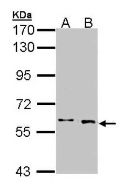 Western Blot: MAX binding protein Antibody [NBP1-32757] - Sample (30 ug of whole cell lysate)A: A431 B: HeLa7. 5% SDS PAGE, antibody diluted at 1:1000.