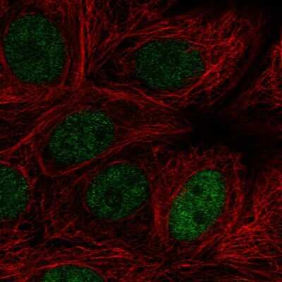 Immunocytochemistry/Immunofluorescence: MAZ Antibody [NBP2-56933] - Staining of human cell line MCF7 shows localization to nucleoplasm.