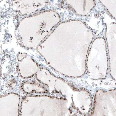 Immunohistochemistry-Paraffin: MAZ Antibody [NBP2-33519] - Staining of human thyroid gland shows moderate nuclear positivity in glandular cells.