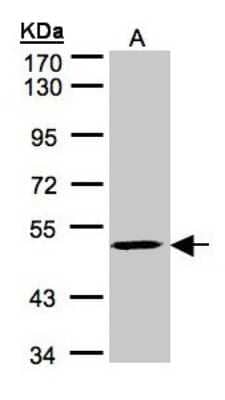 Western Blot: MAZ Antibody [NBP1-32119] - Sample(30 ug of whole cell lysate)A:HeLa S3 7. 5% SDS PAGE, antibody diluted at 1:1000.