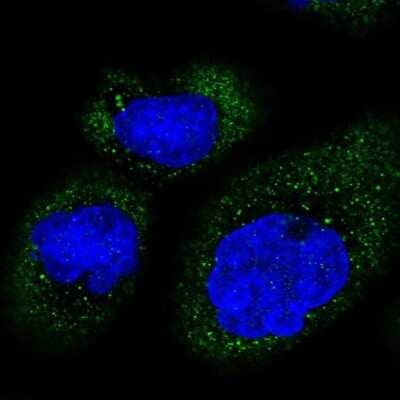 Immunocytochemistry/Immunofluorescence: MB21D2 Antibody [NBP1-92101] - Immunofluorescent staining of human cell line A-431 shows localization to cytosol.