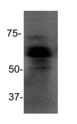 Western Blot: MBD1 Antibody (100B272.1) - Azide and BSA Free [NBP2-33221] - Analysis of Jurkat cell lysate using anti-MBD1 antibody. Image from verified customer review.