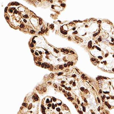 Immunohistochemistry-Paraffin: MBD3 Antibody (106B691) [NB100-56534] - MBD3 was detected in immersion fixed paraffin-embedded sections of human placenta using Mouse Anti-Human MBD3 (106B691) Monoclonal Antibody (Catalog # NB100-56534) at 1:300 for 1 hour at room temperature followed by incubation with the Anti-Mouse IgG VisUCyte™ HRP Polymer Antibody (Catalog # VC001). Tissue was stained using DAB (brown) and counterstained with hematoxylin (blue). Specific staining was localized to cell nuclei in horionic villi.