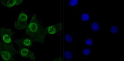 Immunocytochemistry/Immunofluorescence: MBD3 Antibody (JB61-47) [NBP2-75568] - Staining MBD3 in A549 cells (green). The nuclear counter stain is DAPI (blue). Cells were fixed in paraformaldehyde, permeabilised with 0.25% Triton X100/PBS.