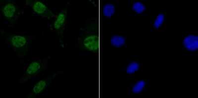 Immunocytochemistry/Immunofluorescence: MBD3 Antibody (JB61-47) [NBP2-75568] - Staining MBD3 in SH-SY-5Y cells (green). The nuclear counter stain is DAPI (blue). Cells were fixed in paraformaldehyde, permeabilised with 0.25% Triton X100/PBS.