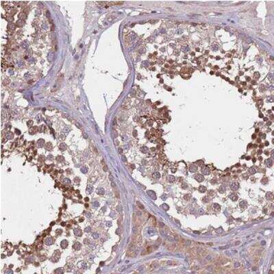 Immunohistochemistry MBD3L1 Antibody - BSA Free
