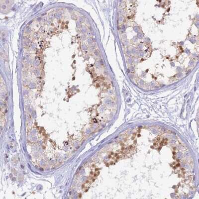 Immunohistochemistry-Paraffin: MBD3L1 Antibody [NBP2-30978] - Staining of human testis shows moderate nuclear positivity in spermatids.