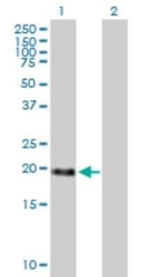 Western Blot: MBD3L1 Antibody [H00085509-B01P] - Analysis of MBD3L1 expression in transfected 293T cell line by MBD3L1 polyclonal antibody.  Lane 1: MBD3L1 transfected lysate(21.34 KDa). Lane 2: Non-transfected lysate.