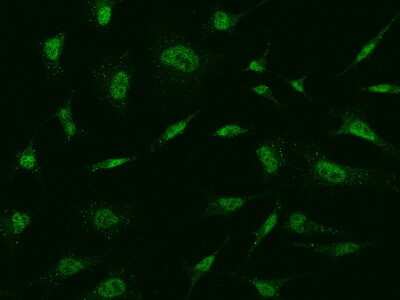 Immunocytochemistry/Immunofluorescence: MBD5 Antibody [NBP2-99368] - Immunofluorescence staining of MBD5 in HeLa cells. Cells were fixed with 4% PFA, permeabilzed with 0.1% Triton X-100 in PBS, blocked with 10% serum, and incubated with rabbit anti-Human MBD5 polyclonal antibody (dilution ratio 1:1000) at 4C overnight. Then cells were stained with the Alexa Fluor(R)488-conjugated Goat Anti-rabbit IgG secondary antibody (green). Positive staining was localized to Nucleus .