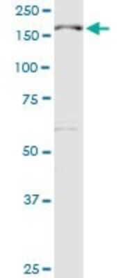 Western Blot: MBD5 Antibody [H00055777-D01P] - Analysis of MBD5 expression in HepG2.