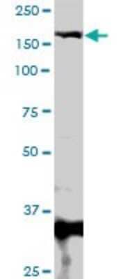 Western Blot: MBD5 Antibody [H00055777-D01P] - Analysis of MBD5 expression in human liver.