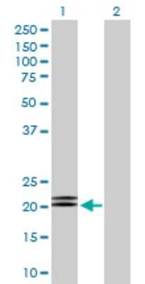 Western Blot: MBD5 Antibody [H00055777-D01P] - Analysis of MBD5 expression in transfected 293T cell line by MBD5 polyclonal antibody.Lane 1: MBD5 transfected lysate(24.30 KDa).Lane 2: Non-transfected lysate.