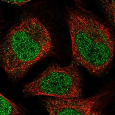 Immunocytochemistry/ Immunofluorescence MBD6 Antibody