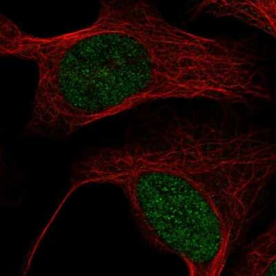 Immunocytochemistry/ Immunofluorescence MBD6 Antibody - BSA Free