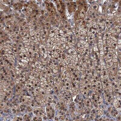 Immunohistochemistry MBD6 Antibody