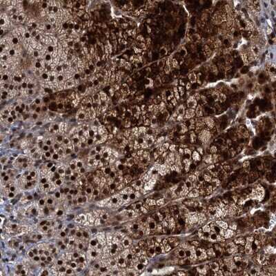 Immunohistochemistry MBD6 Antibody - BSA Free
