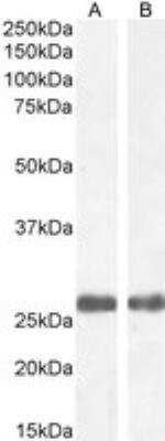 Western Blot: MBL Antibody [NB100-1502] - Staining of Human Heart (A) and Liver (B) lysate (35 ug protein in RIPA buffer). Antibody at 1 ug/mL. Detected by chemiluminescence.