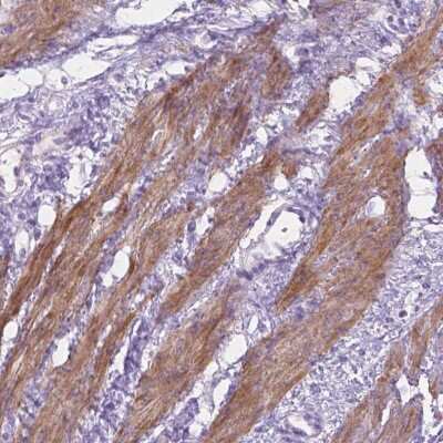 Immunohistochemistry-Paraffin: MBLAC1 Antibody [NBP2-49665] - Staining of human smooth muscle shows moderate cytoplasmic positivity in smooth muscle cells.