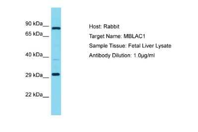 Western Blot: MBLAC1 Antibody [NBP2-83184] - Host: Rabbit. Target Name: MBLAC1. Sample Type: Fetal Liver lysates. Antibody Dilution: 1.0ug/ml