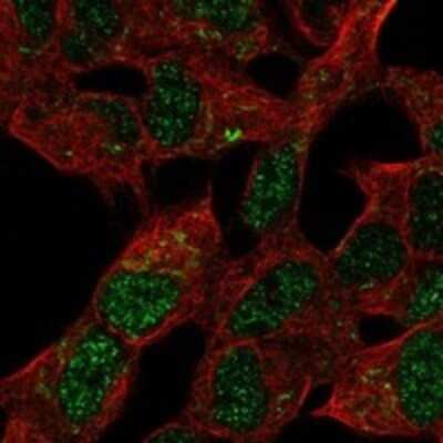 Immunocytochemistry/ Immunofluorescence MBLAC2 Antibody - BSA Free