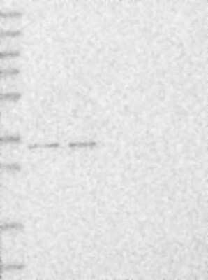 Western Blot MBLAC2 Antibody - BSA Free