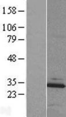 Western Blot MBLAC2 Overexpression Lysate