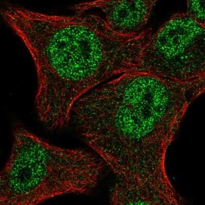 Immunocytochemistry/Immunofluorescence: MBNL2 Antibody [NBP2-57273] - Staining of human cell line SK-MEL-30 shows localization to nucleoplasm.